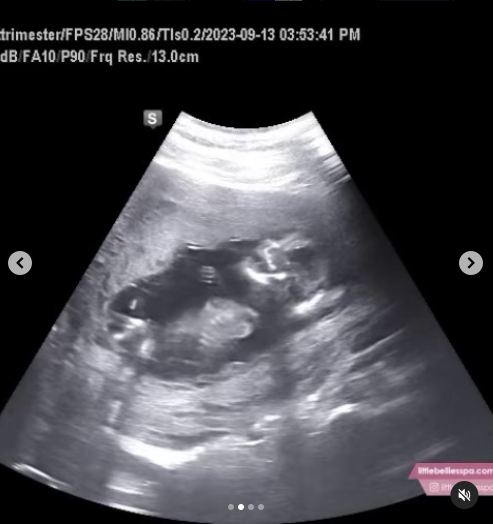 Chilli's Son Tron Austin Announces He & His Wife Are Expecting Their First  Baby! - theJasmineBRAND
