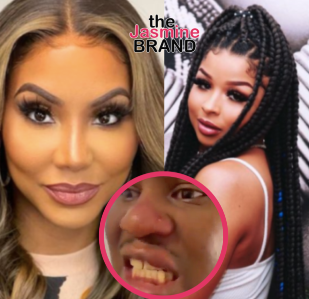 Update: Tamar Braxton Shares Unseen Footage Of James Wright Chanel’s Injuries After Being Physically Assaulted By Chrisean Rock: ‘Nobody Is Lying On Nobody’
