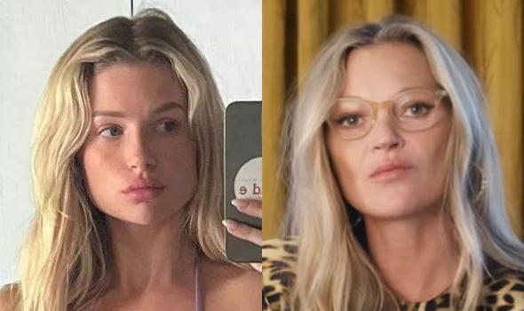 Kate Moss’ Sister Lottie Moss Details Frightening Hospitalization After Ozempic Overdose