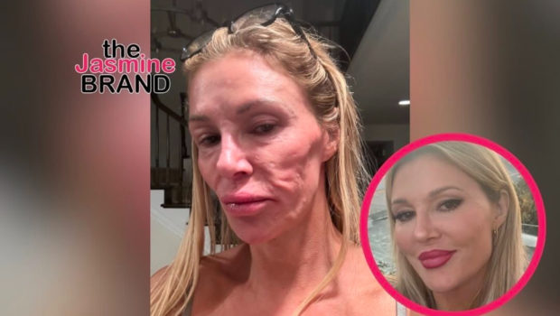 ‘RHOBH’ Alum Brandi Glanville Blames Bravo For Face Disfigurement Following Legal Drama w/ The Network