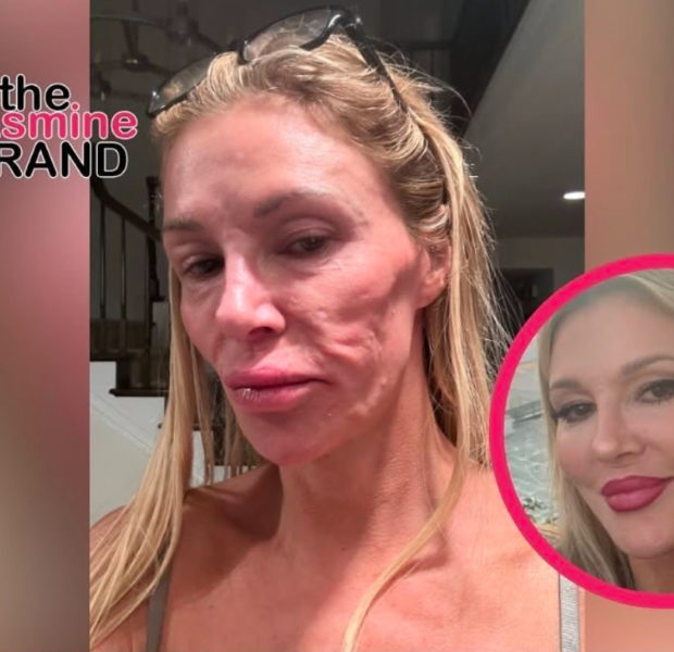 ‘RHOBH’ Alum Brandi Glanville Blames Bravo For Face Disfigurement Following Legal Drama w/ The Network