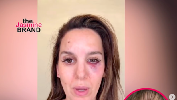 Actress Christy Carlson Romano Says She’s ‘Grateful To Be Alive’ After Being Sh*t In The Face During Husband’s Birthday Trip