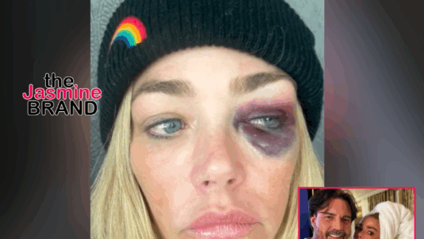 ‘RHOBH’ Alum Denise Richards Granted Restraining Order Against Estranged Husband Aaron Phypers, Claims He Gave Her 3 Concussions