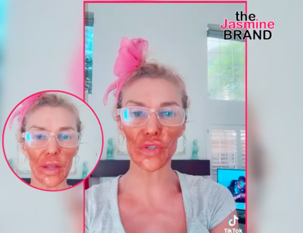‘RHOBH’ Alum Brandi Glanville Severely Burns Her Face After Using Nair In An Attempt To Kill Facial Parasite