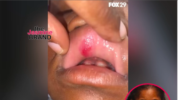 Philly Daycare Worker Accused Of Assaulting 6-Year-Old, Child’s Mom Speaks Out: ‘Why Did No One Help My Daughter?’ [VIDEO]