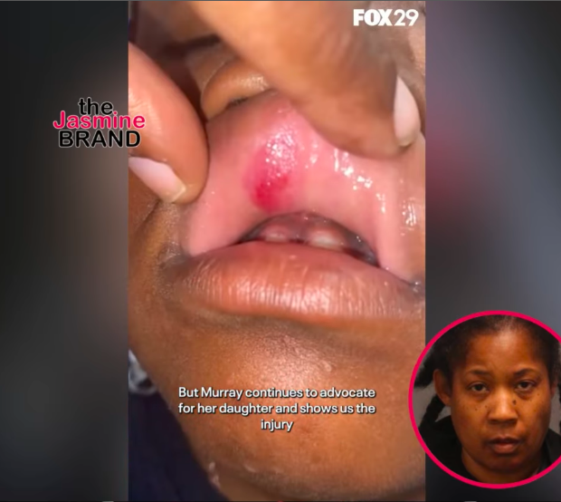 Philly Daycare Worker Accused Of Assaulting 6-Year-Old, Child’s Mom Speaks Out: ‘Why Did No One Help My Daughter?’ [VIDEO]