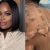 RHOA’s Shamea Morton Claims Chemical Peel Left Her Blistered and Permanently Scarred, Sues Doctor Boost