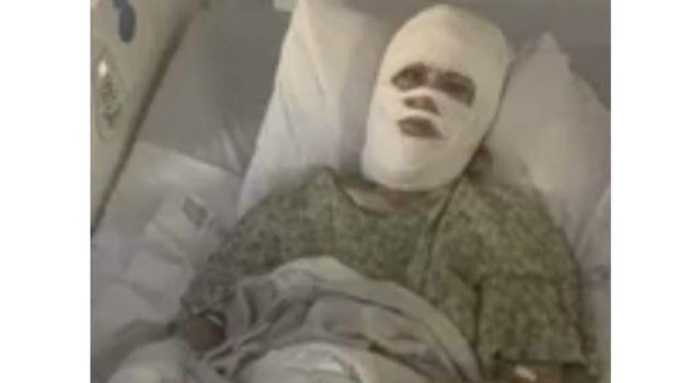 Woman Doused With Chemical in Savannah Park, Suffers Third-Degree Burns