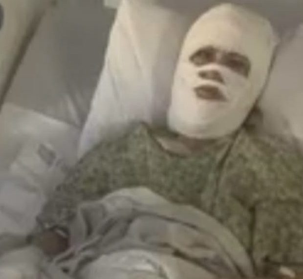 Woman Doused With Chemical in Savannah Park, Suffers Third-Degree Burns