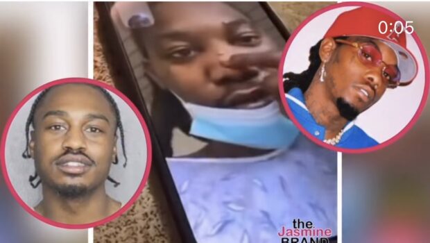 Offset Shows Off Battle Scars To Friend On FaceTime Following Alleged Fight With Fellow Rapper Lil Tjay