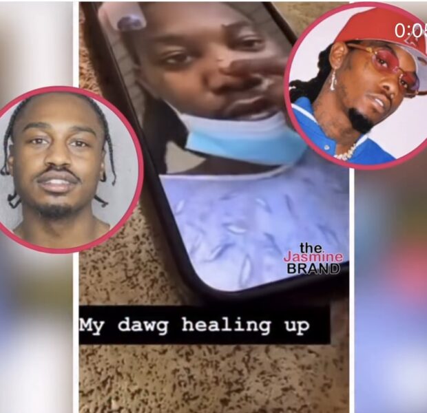 Offset Shows Off Battle Scars To Friend On FaceTime Following Alleged Fight With Fellow Rapper Lil Tjay
