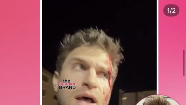 “Pretty Little Liars” Actor Keegan Allen Left Bloodied After Being P!stol-Whipped & Robbed At G*npoint