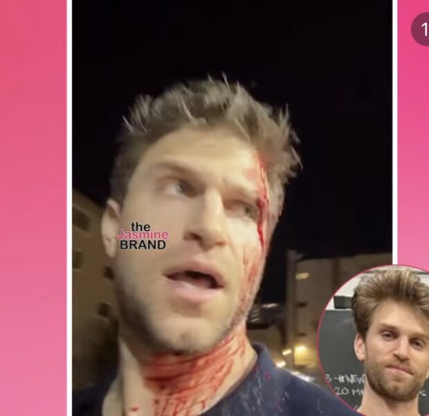 “Pretty Little Liars” Actor Keegan Allen Left Bloodied After Being P!stol-Whipped & Robbed At G*npoint